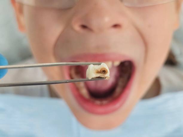 Best Weekend Emergency Dentist in Crownpoint, NM